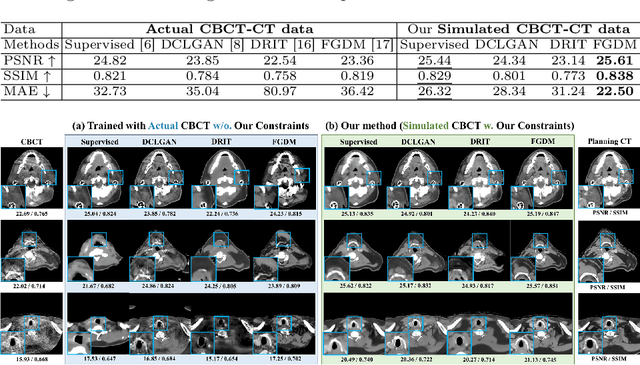 Figure 2 for SinoSynth: A Physics-based Domain Randomization Approach for Generalizable CBCT Image Enhancement