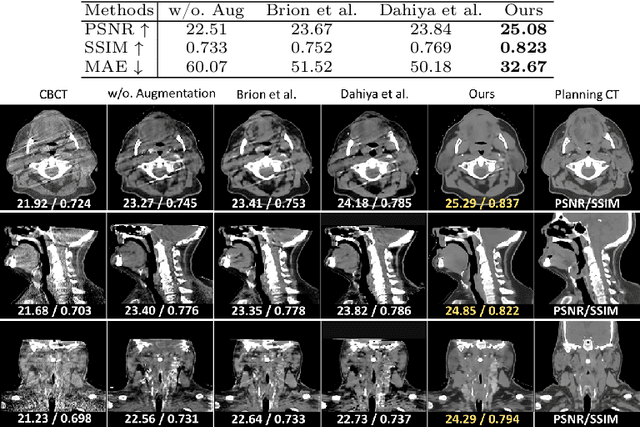 Figure 4 for SinoSynth: A Physics-based Domain Randomization Approach for Generalizable CBCT Image Enhancement