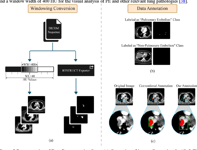 Figure 4 for Deep Learning in Computed Tomography Pulmonary Angiography Imaging: A Dual-Pronged Approach for Pulmonary Embolism Detection