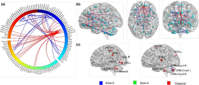 Figure 3 for Multi-Stage Graph Learning for fMRI Analysis to Diagnose Neuro-Developmental Disorders