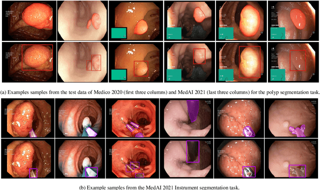 Figure 3 for An objective validation of polyp and instrument segmentation methods in colonoscopy through Medico 2020 polyp segmentation and MedAI 2021 transparency challenges