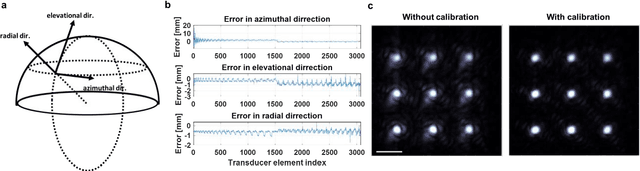 Figure 2 for Single-shot 3D photoacoustic computed tomography with a densely packed array for transcranial functional imaging