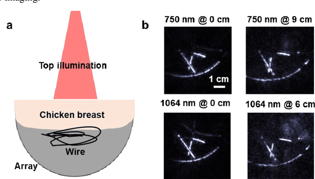 Figure 4 for Single-shot 3D photoacoustic computed tomography with a densely packed array for transcranial functional imaging