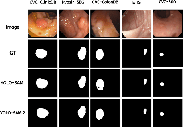 Figure 3 for Self-Prompting Polyp Segmentation in Colonoscopy using Hybrid Yolo-SAM 2 Model