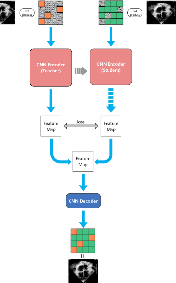 Figure 1 for EDMAE: An Efficient Decoupled Masked Autoencoder for Standard View Identification in Pediatric Echocardiography