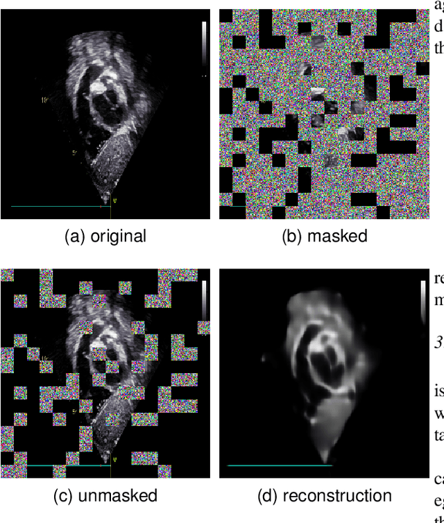 Figure 3 for EDMAE: An Efficient Decoupled Masked Autoencoder for Standard View Identification in Pediatric Echocardiography