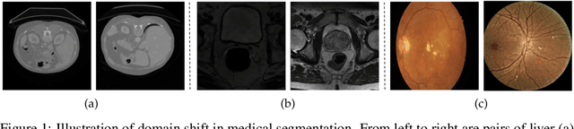 Figure 1 for On the Out of Distribution Robustness of Foundation Models in Medical Image Segmentation