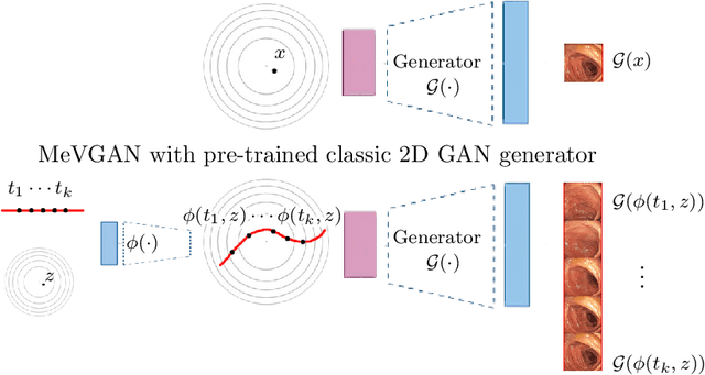 Figure 1 for MeVGAN: GAN-based Plugin Model for Video Generation with Applications in Colonoscopy