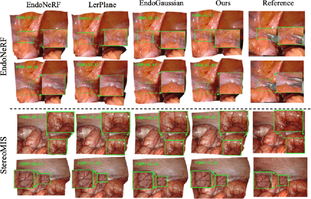 Figure 4 for Deform3DGS: Flexible Deformation for Fast Surgical Scene Reconstruction with Gaussian Splatting