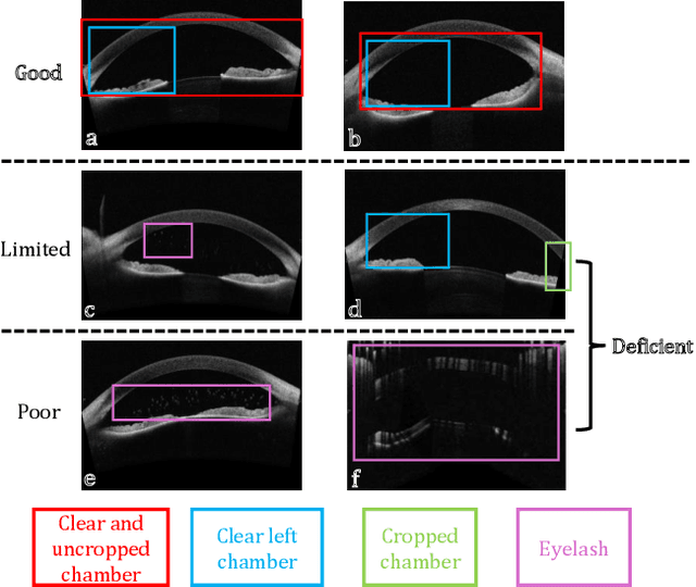 Figure 1 for Medical Image Quality Assessment based on Probability of Necessity and Sufficiency