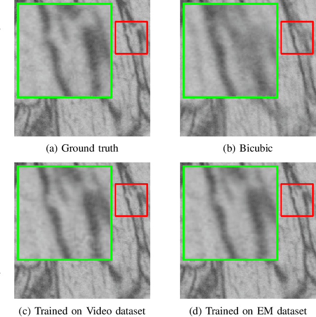 Figure 1 for Z-upscaling: Optical Flow Guided Frame Interpolation for Isotropic Reconstruction of 3D EM Volumes