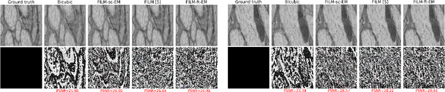 Figure 3 for Z-upscaling: Optical Flow Guided Frame Interpolation for Isotropic Reconstruction of 3D EM Volumes