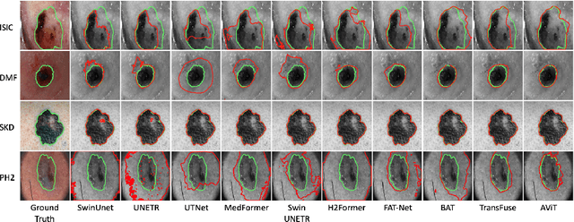 Figure 3 for AViT: Adapting Vision Transformers for Small Skin Lesion Segmentation Datasets