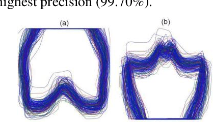 Figure 2 for Segmentation of Knee Bones for Osteoarthritis Assessment: A Comparative Analysis of Supervised, Few-Shot, and Zero-Shot Learning Approaches