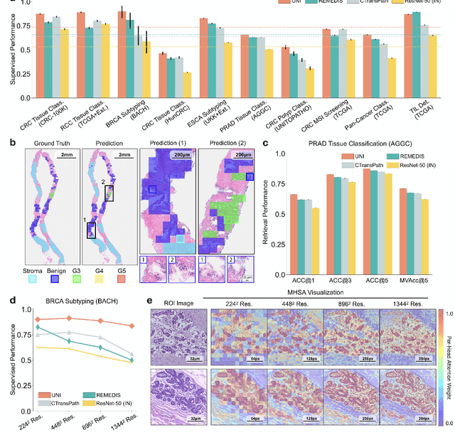 Figure 3 for A General-Purpose Self-Supervised Model for Computational Pathology