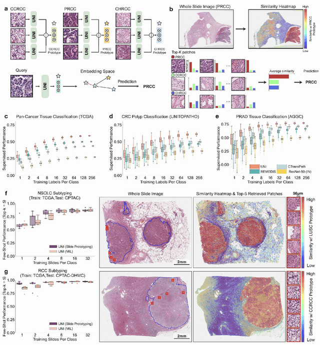 Figure 4 for A General-Purpose Self-Supervised Model for Computational Pathology