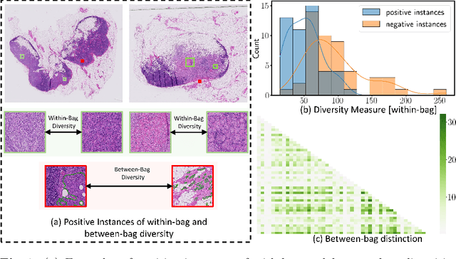 Figure 1 for DGR-MIL: Exploring Diverse Global Representation in Multiple Instance Learning for Whole Slide Image Classification