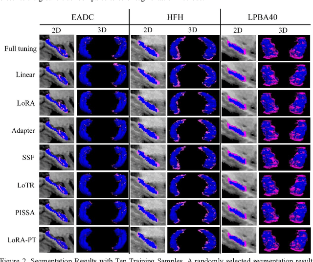 Figure 4 for LoRA-PT: Low-Rank Adapting UNETR for Hippocampus Segmentation Using Principal Tensor Singular Values and Vectors