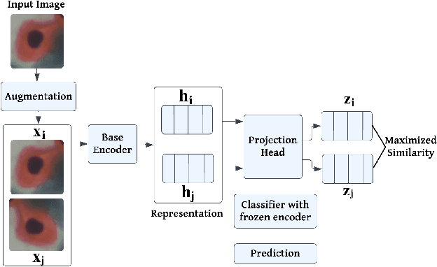 Figure 2 for Explainable Contrastive and Cost-Sensitive Learning for Cervical Cancer Classification