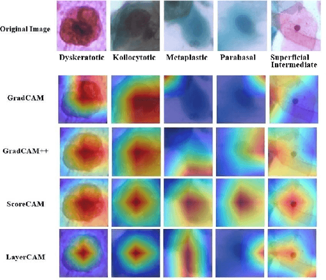 Figure 3 for Explainable Contrastive and Cost-Sensitive Learning for Cervical Cancer Classification