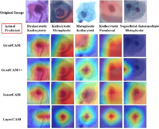 Figure 4 for Explainable Contrastive and Cost-Sensitive Learning for Cervical Cancer Classification