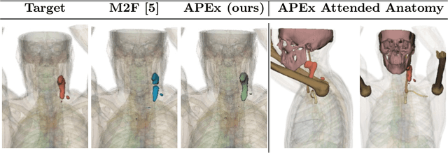 Figure 4 for Anatomy-guided Pathology Segmentation