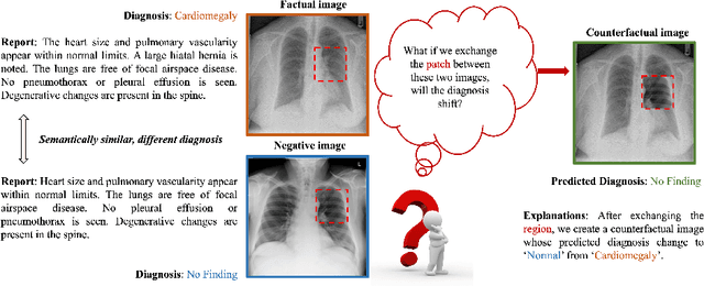 Figure 1 for Contrastive Learning with Counterfactual Explanations for Radiology Report Generation