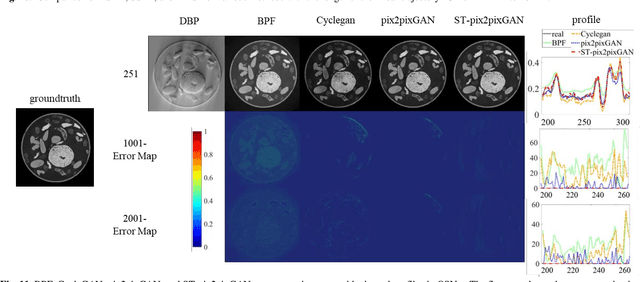 Figure 3 for OSNet & MNetO: Two Types of General Reconstruction Architectures for Linear Computed Tomography in Multi-Scenarios