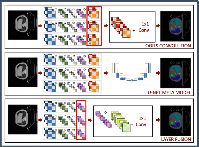 Figure 1 for Ensemble Methods for Multi-Organ Segmentation in CT Series