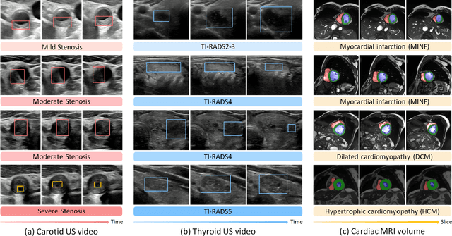 Figure 1 for Ctrl-GenAug: Controllable Generative Augmentation for Medical Sequence Classification