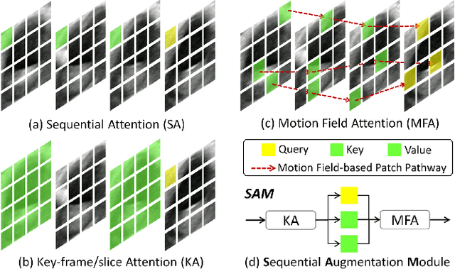 Figure 4 for Ctrl-GenAug: Controllable Generative Augmentation for Medical Sequence Classification