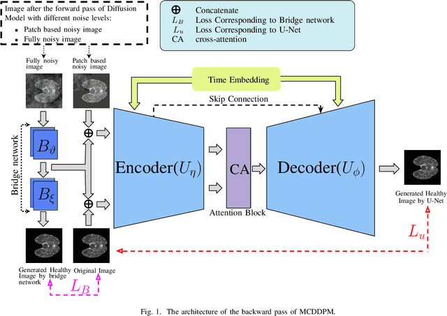 Figure 1 for MCDDPM: Multichannel Conditional Denoising Diffusion Model for Unsupervised Anomaly Detection in Brain MRI