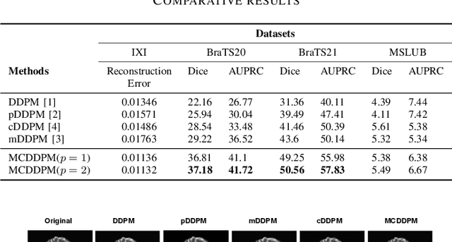 Figure 4 for MCDDPM: Multichannel Conditional Denoising Diffusion Model for Unsupervised Anomaly Detection in Brain MRI