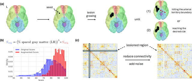 Figure 3 for A Lesion-aware Edge-based Graph Neural Network for Predicting Language Ability in Patients with Post-stroke Aphasia