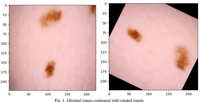 Figure 1 for Advancing Melanoma Diagnosis with Self-Supervised Neural Networks: Evaluating the Effectiveness of Different Techniques