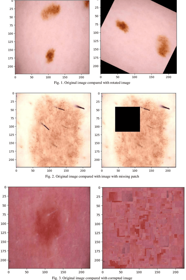 Figure 3 for Advancing Melanoma Diagnosis with Self-Supervised Neural Networks: Evaluating the Effectiveness of Different Techniques