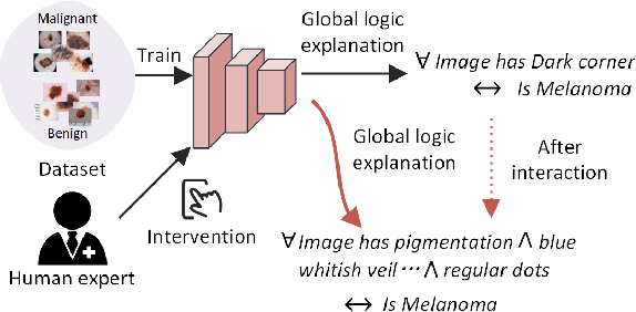 Figure 1 for Towards Trustable Skin Cancer Diagnosis via Rewriting Model's Decision