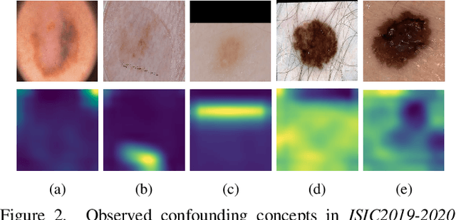 Figure 3 for Towards Trustable Skin Cancer Diagnosis via Rewriting Model's Decision