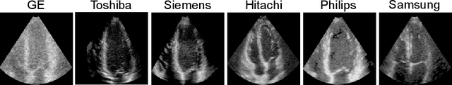 Figure 1 for Deep Spatiotemporal Clutter Filtering of Transthoracic Echocardiographic Images Using a 3D Convolutional Auto-Encoder