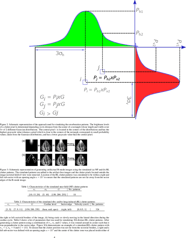 Figure 2 for Deep Spatiotemporal Clutter Filtering of Transthoracic Echocardiographic Images Using a 3D Convolutional Auto-Encoder