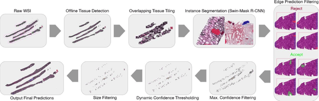 Figure 1 for Segmentation of diagnostic tissue compartments on whole slide images with renal thrombotic microangiopathies (TMAs)