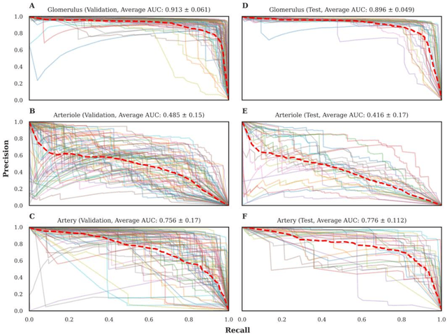 Figure 3 for Segmentation of diagnostic tissue compartments on whole slide images with renal thrombotic microangiopathies (TMAs)