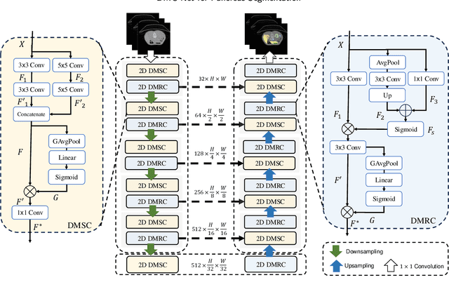 Figure 1 for DMC-Net: Lightweight Dynamic Multi-Scale and Multi-Resolution Convolution Network for Pancreas Segmentation in CT Images