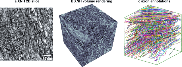 Figure 1 for The XPRESS Challenge: Xray Projectomic Reconstruction -- Extracting Segmentation with Skeletons