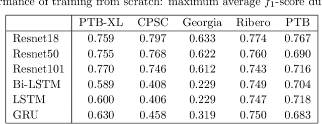 Figure 4 for Transfer Learning in ECG Diagnosis: Is It Effective?