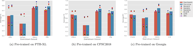 Figure 2 for Transfer Learning in ECG Diagnosis: Is It Effective?