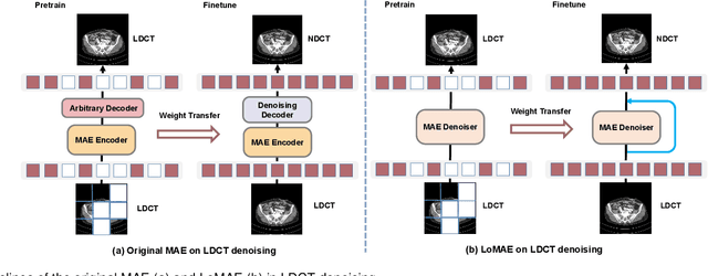 Figure 1 for LoMAE: Low-level Vision Masked Autoencoders for Low-dose CT Denoising