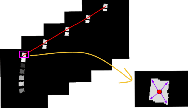 Figure 1 for Panoptic Segmentation and Labelling of Lumbar Spine Vertebrae using Modified Attention Unet