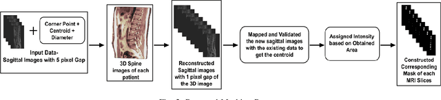 Figure 3 for Panoptic Segmentation and Labelling of Lumbar Spine Vertebrae using Modified Attention Unet