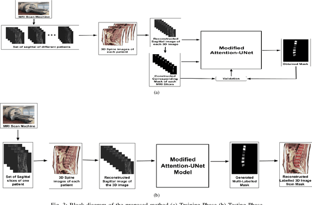 Figure 4 for Panoptic Segmentation and Labelling of Lumbar Spine Vertebrae using Modified Attention Unet